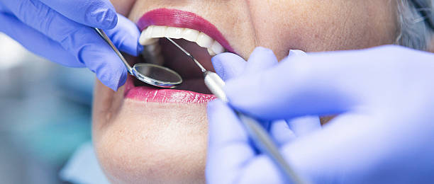 Best Emergency Treatment for Toothache in Young Harris, GA