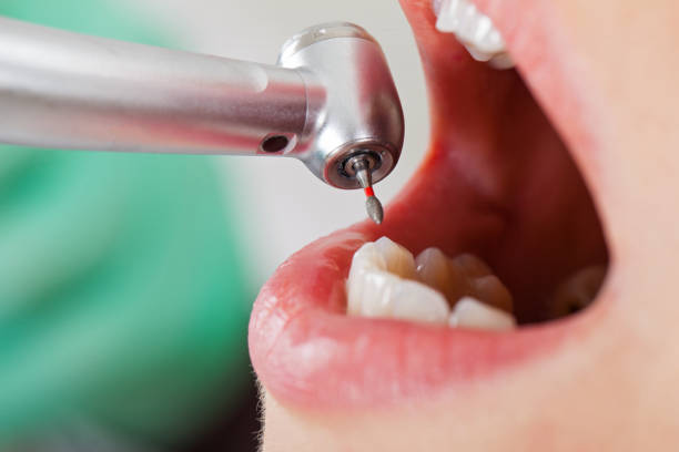 Best Emergency Broken Tooth Repair in Young Harris, GA